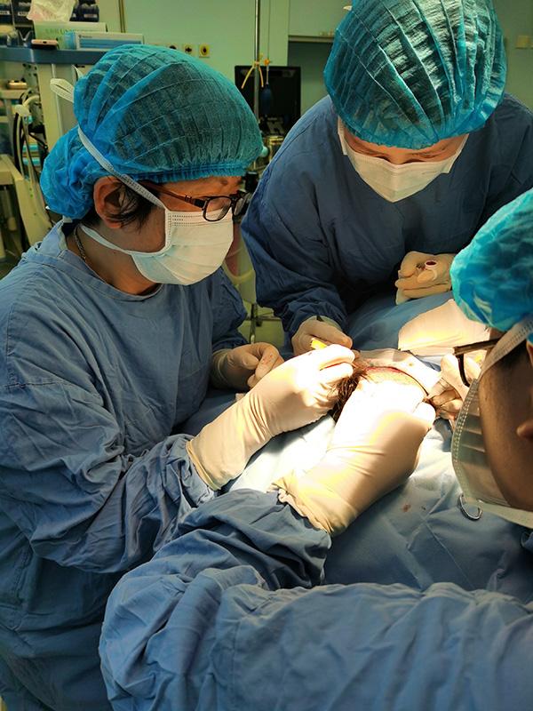 女子发际线异常增高导致社恐，上海医生为其植入自体毛囊单位