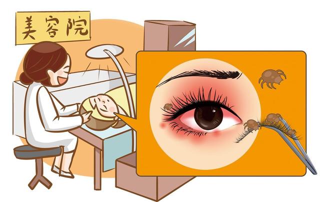 种睫毛“种”出眼疾，医院暑期接诊量明显增加，专家提醒：种植睫毛需谨慎，当心求美不得反伤眼