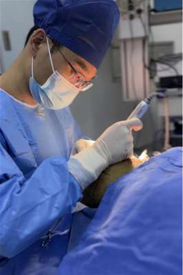 专业胡须种植的医院(30岁男博士“嘴上无毛”，医生巧用毛发移植帮其重塑“阳刚气”)